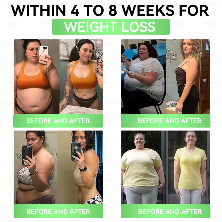 𝐆𝐞𝐧𝐚𝐲𝐮® 𝐌𝐨𝐫𝐢𝐧𝐠𝐚 × 𝐁𝐞𝐫𝐛𝐞𝐫𝐢𝐧𝐞 × 𝐀𝐌𝐏𝐊 𝟖-𝐁𝐞𝐧𝐞𝐟𝐢𝐭 𝐒𝐥𝐢𝐦𝐦𝐢𝐧𝐠 & 𝐌𝐞𝐭𝐚𝐛𝐨𝐥𝐢𝐜 𝐍𝐚𝐧𝐨 𝐌𝐢𝐜𝐫𝐨𝐧𝐞𝐞𝐝𝐥𝐞 𝐏𝐚𝐭𝐜𝐡🇺🇸(𝐉𝐮𝐬𝐭 𝐨𝐧𝐜𝐞 𝐚 𝐝𝐚𝐲, 𝐯𝐢𝐬𝐢𝐛𝐥𝐞 𝐜𝐡𝐚𝐧𝐠𝐞𝐬 𝐢𝐧 𝟕 𝐝𝐚𝐲𝐬） ✅ 𝐅𝐨𝐫 𝐨𝐛𝐞𝐬𝐢𝐭𝐲, 𝐋𝐨𝐨𝐬𝐞 𝐒𝐤𝐢𝐧,𝐝𝐢𝐚𝐛𝐞𝐭𝐞𝐬, 𝐬𝐥𝐞𝐞𝐩 𝐚𝐩𝐧𝐞𝐚, 𝐣𝐨𝐢𝐧𝐭 𝐢𝐬𝐬𝐮𝐞𝐬, 𝐚𝐧𝐝 𝐦𝐨𝐫𝐞 💥💥